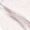 VP19 Contour Stick