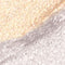 VP21 Contour Stick